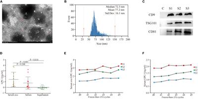 Serum exosomal and serum glypican-1 are associated with early recurrence of pancreatic ductal adenocarcinoma